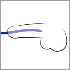  You2Toys - DILATOR - синьо силиконово дилдо за разширяване на уретрата (3бр.)